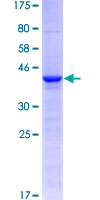 CLLU1OS Protein - 12.5% SDS-PAGE of human CLLU1OS stained with Coomassie Blue
