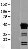 CLMP / ACAM Protein - Western validation with an anti-DDK antibody * L: Control HEK293 lysate R: Over-expression lysate