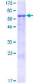 CLMP / ACAM Protein - 12.5% SDS-PAGE of human ASAM stained with Coomassie Blue