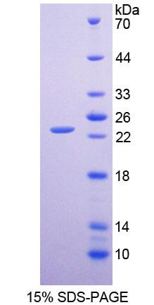 CLMP / ACAM Protein - Recombinant  Coxsackie And Adenovirus Receptor Like Membrane Protein By SDS-PAGE