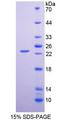 CLMP / ACAM Protein - Recombinant  Coxsackie And Adenovirus Receptor Like Membrane Protein By SDS-PAGE