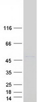 CLMP / ACAM Protein - Purified recombinant protein CLMP was analyzed by SDS-PAGE gel and Coomassie Blue Staining