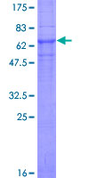 CLN3 Protein - 12.5% SDS-PAGE of human CLN3 stained with Coomassie Blue