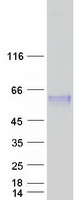 CLN5 Protein - Purified recombinant protein CLN5 was analyzed by SDS-PAGE gel and Coomassie Blue Staining