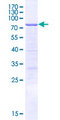 CLNK Protein - 12.5% SDS-PAGE of human CLNK stained with Coomassie Blue