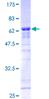 CLNS1A Protein - 12.5% SDS-PAGE of human CLNS1A stained with Coomassie Blue