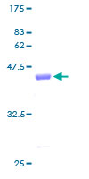 CLP / COTL1 Protein - 12.5% SDS-PAGE of human COTL1 stained with Coomassie Blue