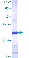 CLP / COTL1 Protein - 12.5% SDS-PAGE Stained with Coomassie Blue.