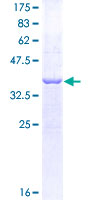 CLP1 Protein - 12.5% SDS-PAGE Stained with Coomassie Blue.