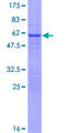 CLPP Protein - 12.5% SDS-PAGE of human CLPP stained with Coomassie Blue