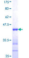 CLPP Protein - 12.5% SDS-PAGE Stained with Coomassie Blue.