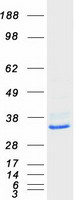 CLPP Protein - Purified recombinant protein CLPP was analyzed by SDS-PAGE gel and Coomassie Blue Staining