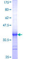 CLPS / Colipase Protein - 12.5% SDS-PAGE Stained with Coomassie Blue.