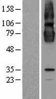 CLPTM1 Protein - Western validation with an anti-DDK antibody * L: Control HEK293 lysate R: Over-expression lysate