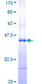 CLPTM1 Protein - 12.5% SDS-PAGE Stained with Coomassie Blue.