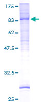 CLPTM1L / CLPTM1-Like Protein - 12.5% SDS-PAGE of human CRR9 stained with Coomassie Blue