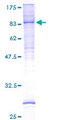 CLPTM1L / CLPTM1-Like Protein - 12.5% SDS-PAGE of human CRR9 stained with Coomassie Blue