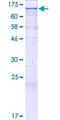 CLSTN2 / Calsyntenin 2 Protein - 12.5% SDS-PAGE of human CLSTN2 stained with Coomassie Blue
