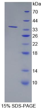 CLSTN2 / Calsyntenin 2 Protein - Recombinant  Calsyntenin 2 By SDS-PAGE