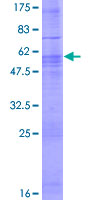 CLSTN3 Protein - 12.5% SDS-PAGE of human CLSTN3 stained with Coomassie Blue