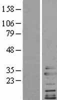 CLTA / LCA Protein - Western validation with an anti-DDK antibody * L: Control HEK293 lysate R: Over-expression lysate