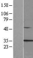 CLTA / LCA Protein - Western validation with an anti-DDK antibody * L: Control HEK293 lysate R: Over-expression lysate