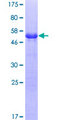 CLTA / LCA Protein - 12.5% SDS-PAGE of human CLTA stained with Coomassie Blue