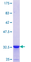 CLTA / LCA Protein - 12.5% SDS-PAGE Stained with Coomassie Blue.