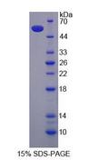 CLTA / LCA Protein - Recombinant Clathrin, Light Polypeptide A (CLTA) by SDS-PAGE