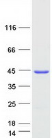 CLTA / LCA Protein - Purified recombinant protein CLTA was analyzed by SDS-PAGE gel and Coomassie Blue Staining