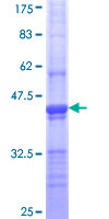 CLTC / Clathrin Heavy Chain Protein - 12.5% SDS-PAGE Stained with Coomassie Blue.