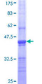 CLTC / Clathrin Heavy Chain Protein - 12.5% SDS-PAGE Stained with Coomassie Blue.
