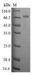 CLU / Clusterin Protein - (Tris-Glycine gel) Discontinuous SDS-PAGE (reduced) with 5% enrichment gel and 15% separation gel.