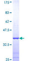 CLU / Clusterin Protein - 12.5% SDS-PAGE Stained with Coomassie Blue.