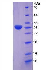 CLU / Clusterin Protein - Recombinant Clusterin By SDS-PAGE