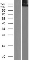 CLU1 / KIAA0664 Protein - Western validation with an anti-DDK antibody * L: Control HEK293 lysate R: Over-expression lysate