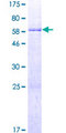 CLVS1 Protein - 12.5% SDS-PAGE of human RLBP1L1 stained with Coomassie Blue