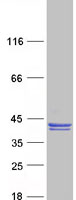 CLVS1 Protein - Purified recombinant protein CLVS1 was analyzed by SDS-PAGE gel and Coomassie Blue Staining