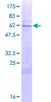 CLYBL Protein - 12.5% SDS-PAGE of human CLYBL stained with Coomassie Blue