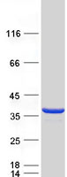 CLYBL Protein - Purified recombinant protein CLYBL was analyzed by SDS-PAGE gel and Coomassie Blue Staining