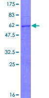 CMAS Protein - 12.5% SDS-PAGE of human CMAS stained with Coomassie Blue