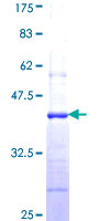 CMAS Protein - 12.5% SDS-PAGE Stained with Coomassie Blue.