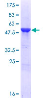 CMBL Protein - 12.5% SDS-PAGE of human CMBL stained with Coomassie Blue