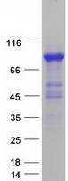CMIP Protein - Purified recombinant protein CMIP was analyzed by SDS-PAGE gel and Coomassie Blue Staining