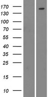 CML / BCR Protein - Western validation with an anti-DDK antibody * L: Control HEK293 lysate R: Over-expression lysate