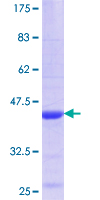 CML / BCR Protein - 12.5% SDS-PAGE Stained with Coomassie Blue.