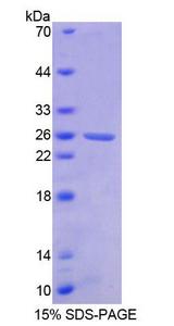 CML / BCR Protein - Recombinant  Breakpoint Cluster Region By SDS-PAGE