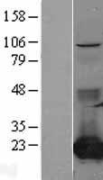 CMPK / CMPK1 Protein - Western validation with an anti-DDK antibody * L: Control HEK293 lysate R: Over-expression lysate