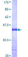 CMPK / CMPK1 Protein - 12.5% SDS-PAGE Stained with Coomassie Blue