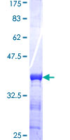 CMPK2 Protein - 12.5% SDS-PAGE Stained with Coomassie Blue.